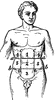 Abdominal