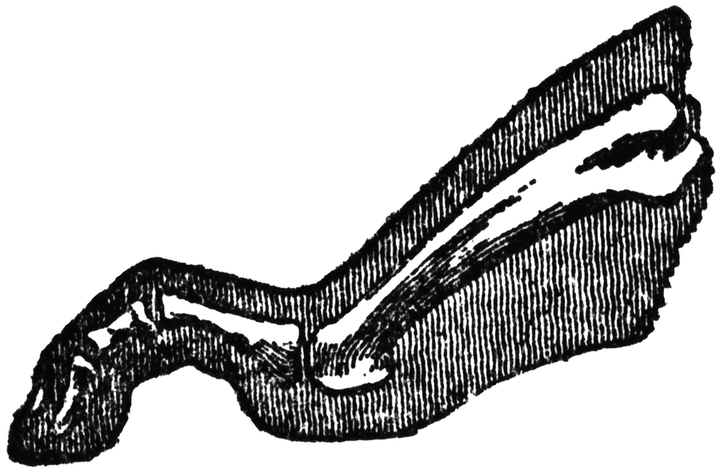 bones of foot. Side View of Bones in Foot