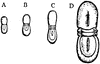Agnostus Nudus