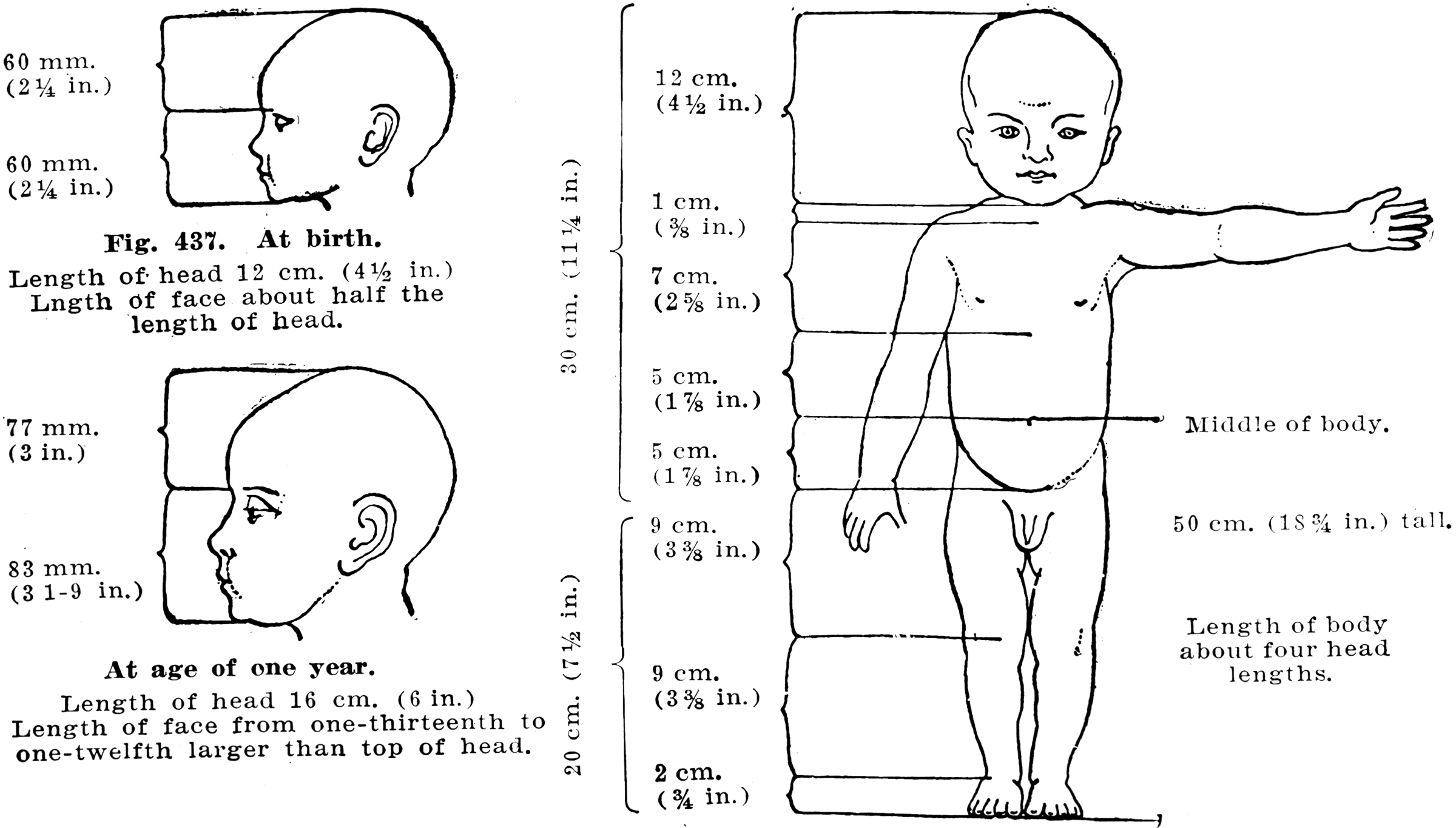 Proportions of a Healthy Child's Body at Birth and Birth and One Year