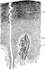 Epidermis and Sweat Gland