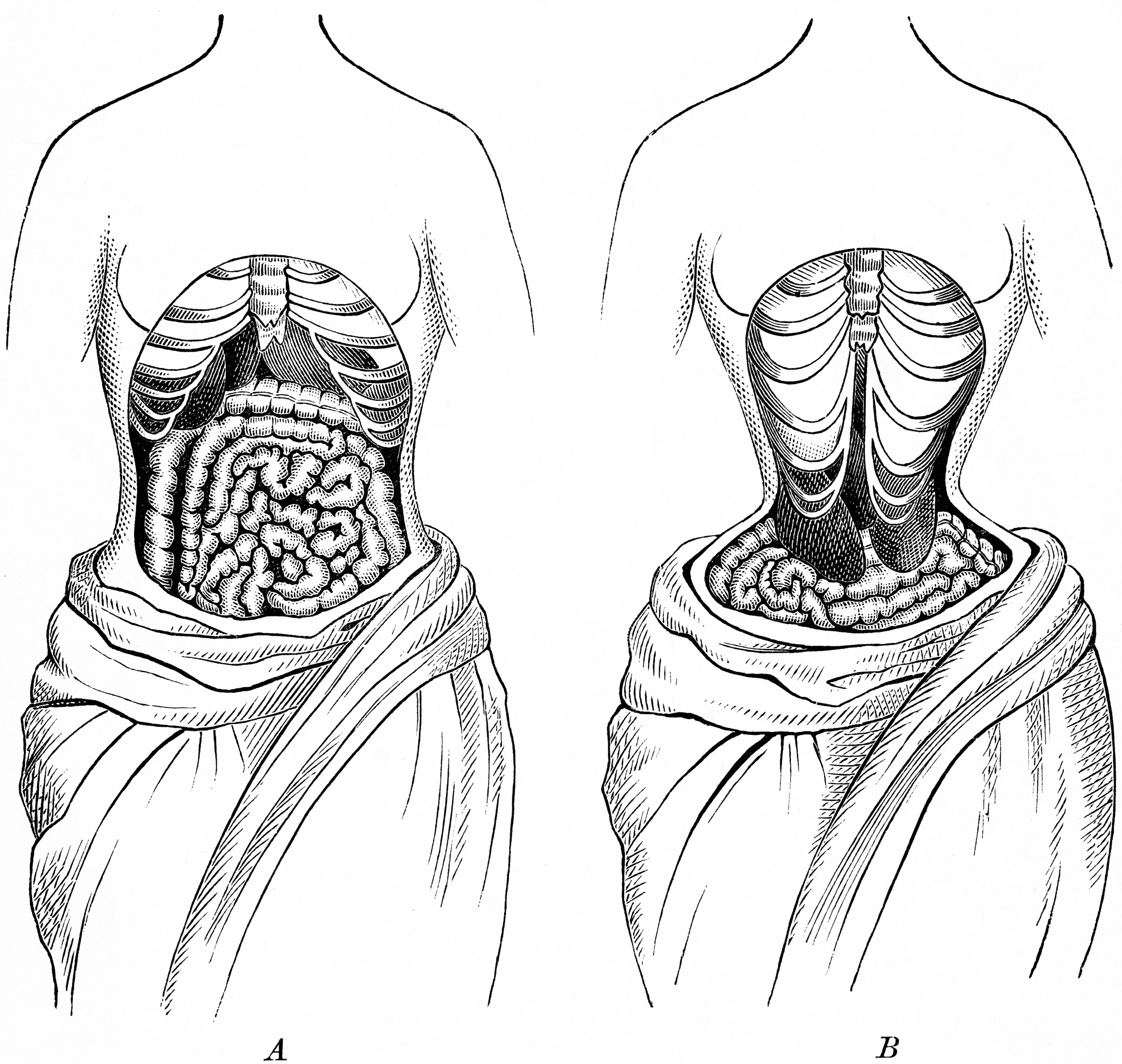 The Natural Position Compared to the Deformed Position of the Internal