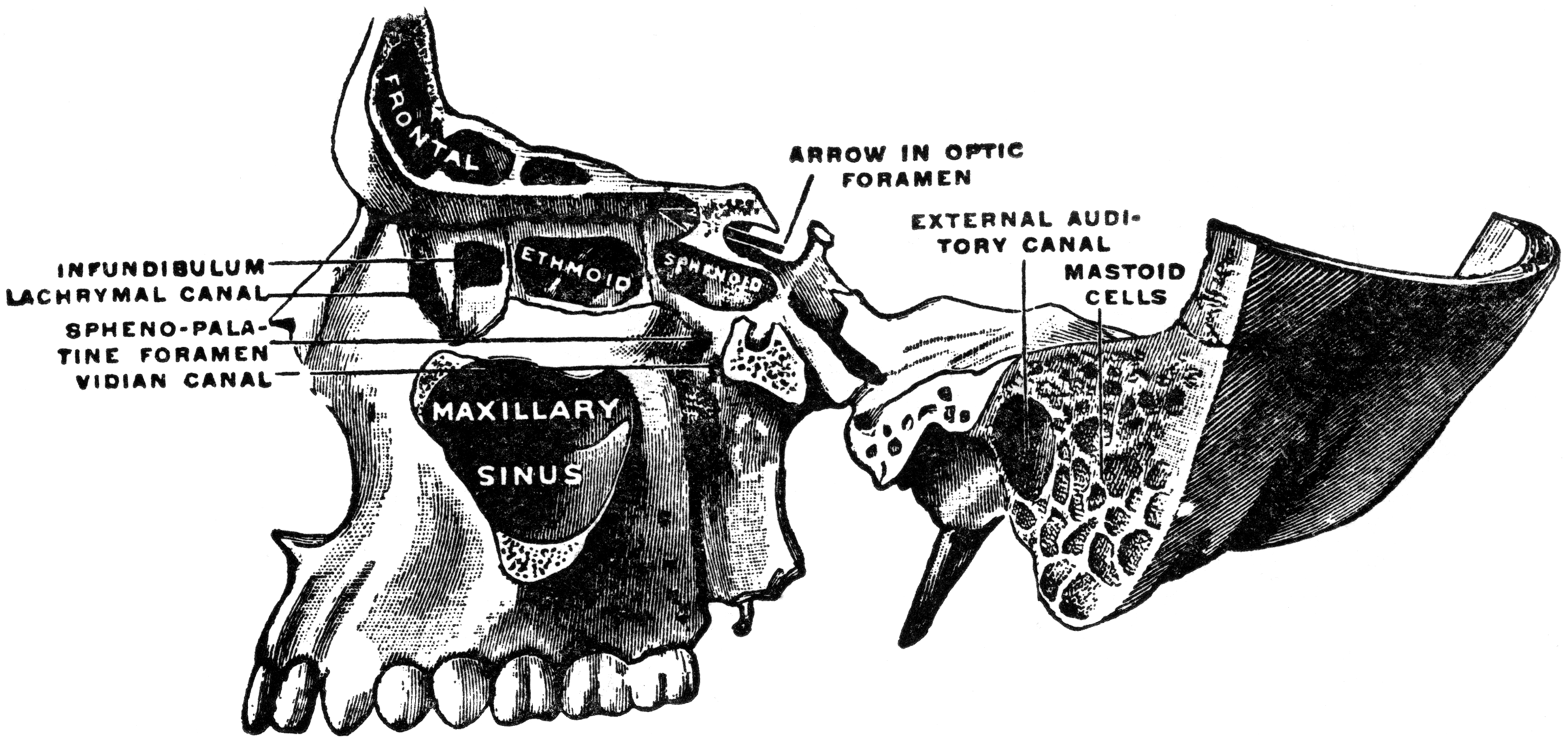 Superior Maxillary Bone and Sinuses | ClipArt ETC