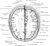 Cross Section of Head 3 cm Above Supraorbital Border