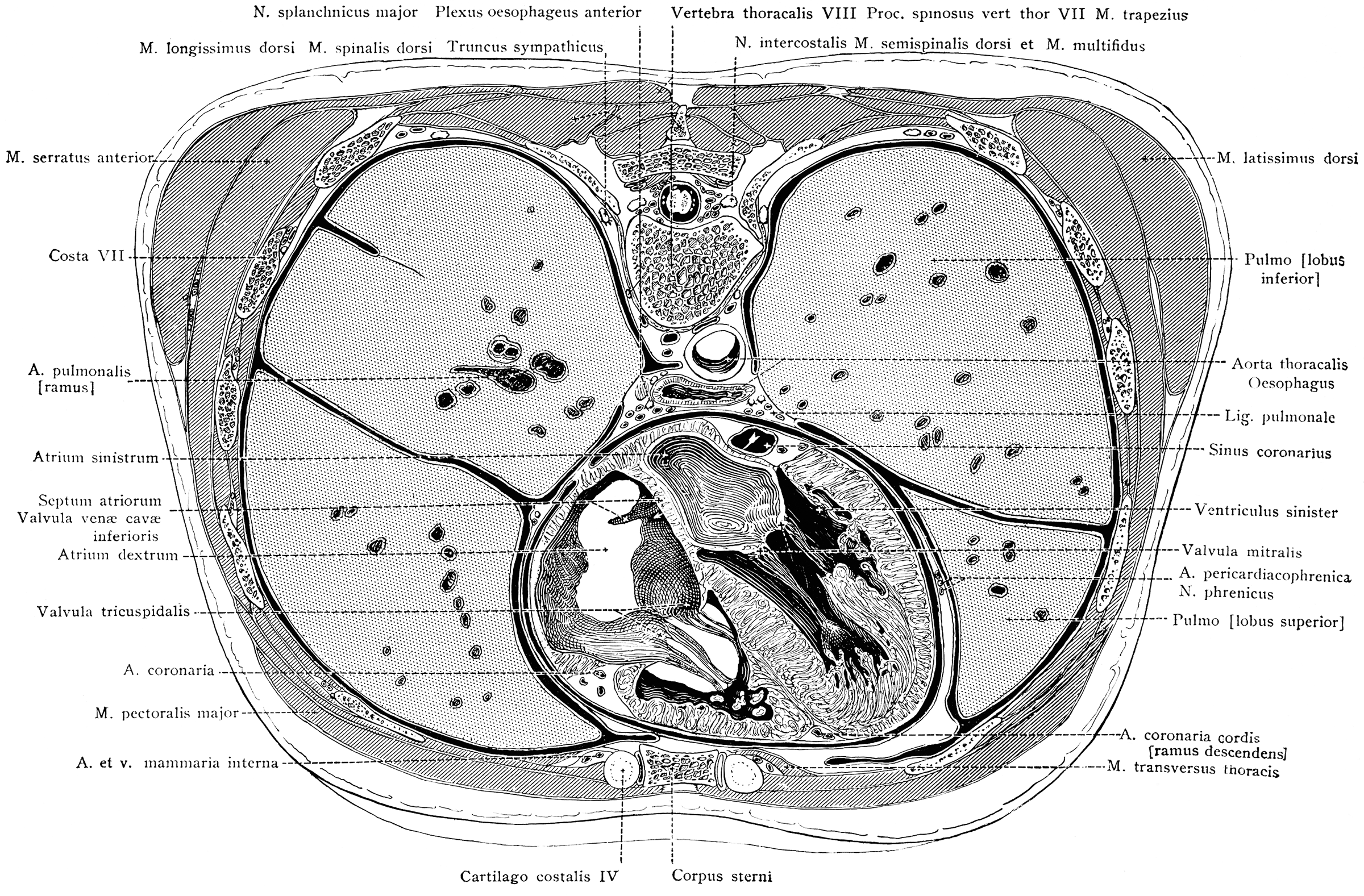 Cross Section of the Trunk Exposing the Ventricles of the Heart