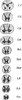 Transverse Sections of Spinal Cord