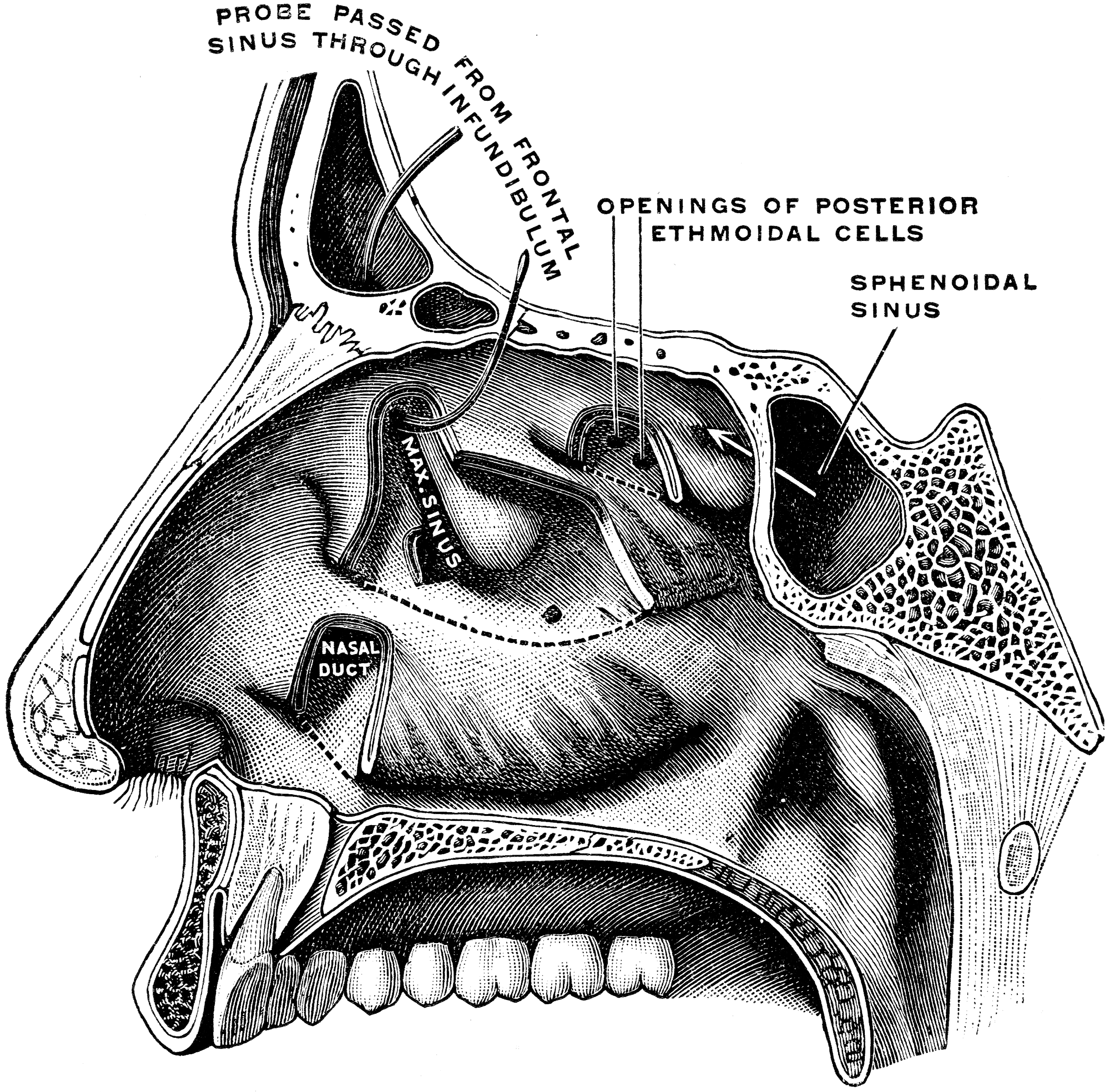 External Wall of Nasal Cavity | ClipArt ETC
