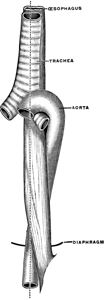 Esophagus  Trachea  And Aorta In An Infant