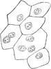 Superficial Layer of Bladder Epithelium