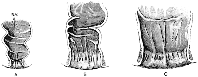 Rectum And Anal Canal In Fetus Clipart Etc