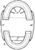 Dental Cup for Impression
