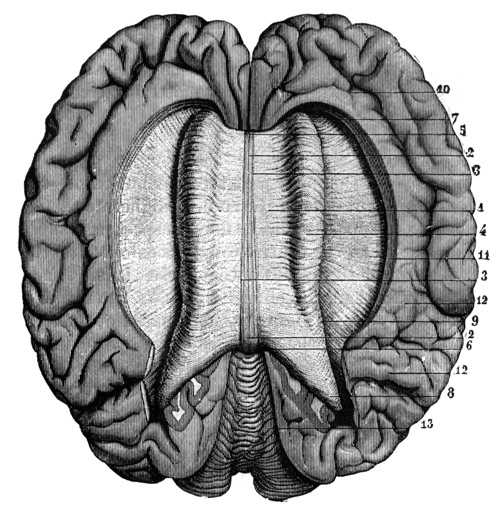 human brain clipart. (Human Brain Clipart)