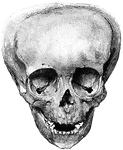 "Showing how the Bones of the Skull may be artificially deformed by "head-binding." From the photograph of a "triangular" skull found in an Indian grave in Ancon, Peru." &mdash; Blaisedell, 1904