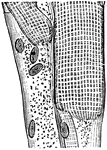 "A Portion of Striped Muscular Fiber, showing Stripes and Nuclei. Highly magnified." — Blaisedell, 1904