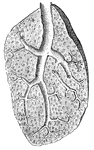 "Showing the structure of a lobule of the lung. The lobule has been injected with mercury, afterwards dried and cut open. A large bronchial tube with its various branches is well shown." &mdash; Blaisedell, 1904