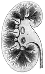 "<em>A</em>, pyramids of the kidney; <em>B</em>, apices, or papillae, of the pyramids; <em>C</em>, pelvis of the kidney; <em>D</em>, upper end of the ureter</em>." &mdash; Blaisedell, 1904