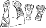 "The thongs or bands of leather, which were tied round the hands of boxers, in order to render their blows more powerful. The cestus was used by boxers in the earliest times, and is mentioned in he Iliad; but in the heroic times it consisted merely of thongs of leather, and differed from the cestos used in later times in the public games, which was a most formidable weapon, being frequently covered with knots and nails, and loaded with lead and iron." &mdash; Smith, 1873