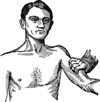 "In bleeding from any part of the arm or hand the branchial artery should be pressed outwards against the bone jujst behind the inner border of the larger muscle of the arm." &mdash; Moss, 1914