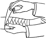 Two hand binding an injury on an arm with a bandage.