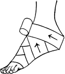 A bandaged foot.