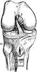 The right knee-joint, laid open from the front. 1: Articular surface of the femur. 2 and 3: Ligaments. 4: Insertion of one of these ligaments into the tibia. 6 and 7: Internal and external cartilages. 8: Ligament of the patella.