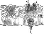 This illustration shows cluster cups in a section of a leaf of spring beauty. At right one of the cups is ruptured, exposing the aeciospores. Below a small cup, pycnium, is discharging pycniospores that are possibly fuunctionless male gametes.
