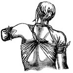 This illustration shows a method of applying a triangular bandage to the chest, shoulder, head and elbow.
