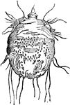 A disease caused by a minute insect, the acarus scabiei, which bores into and underneath the epidermic layer of the skin.