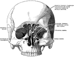 The coronal section through the frontal sinus and nasal fossa.