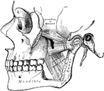 The Pterygoid muscles, the zygomatic arch, and a portion of the ramus of the mandible have been removed.