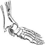 A fracture of the fibula, with dislocation of the foot outward.