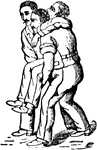 "Method of transporting a wounded person." &mdash; Richardson, 1906