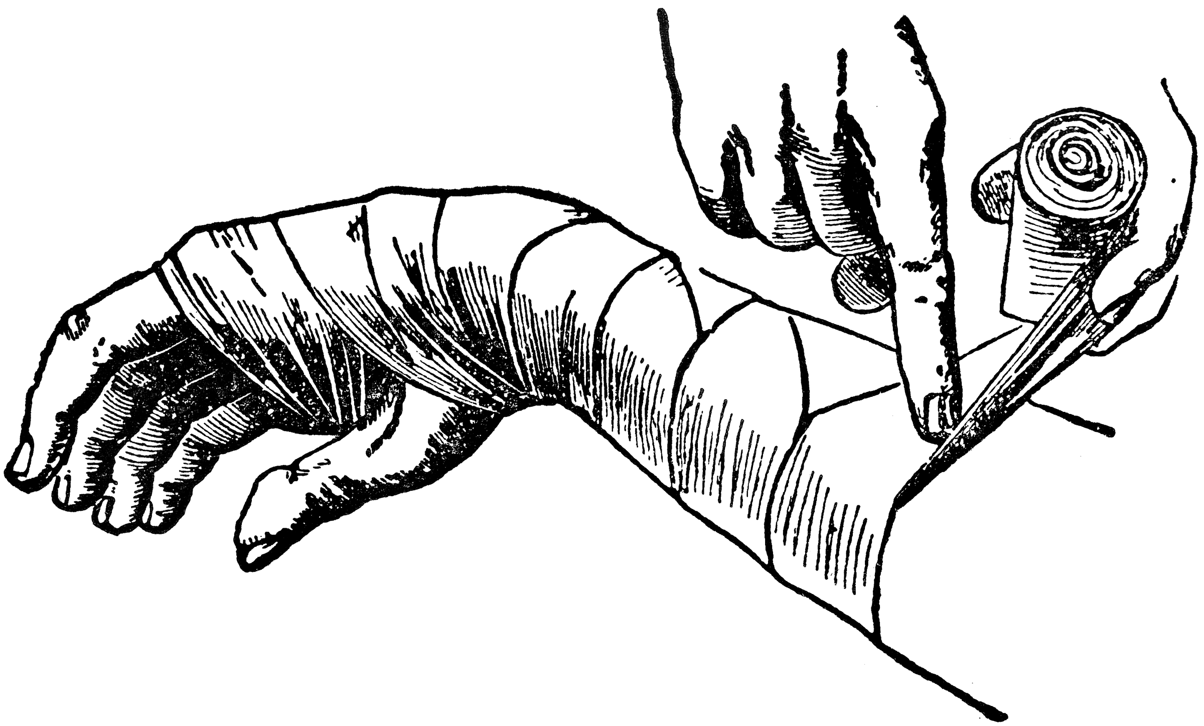 Наложение бинта на рану. Наложение повязок на раны. Перевязка РАН В средневековье.