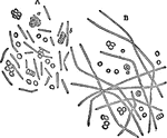 "A. Bacilli mingled with blood corpuscules from the blood of a guinea-pig; some of the bacilli dividing. B. The rodlets after three hours' culture in a drop of aqueos huor. They grow out into long leptothrix-like filaments, which become separate later, and spores are developed in the segments." &mdash; Encyclopedia Britannica, 1910