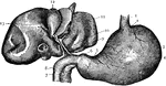 The Stomach and Liver. 1: Esophagus; 2: Cardiac entrance; 3: Large end of stomach; 4: Central portion; 5: Small end of stomach; 6: Pylorus; 7: Portion of Pancreas; 8: Duodenum; 9: Gall duct; 10: Hepatic artery; 11: Left lobe of liver; 12: Gall bladder; 13: Right lobe of liver.