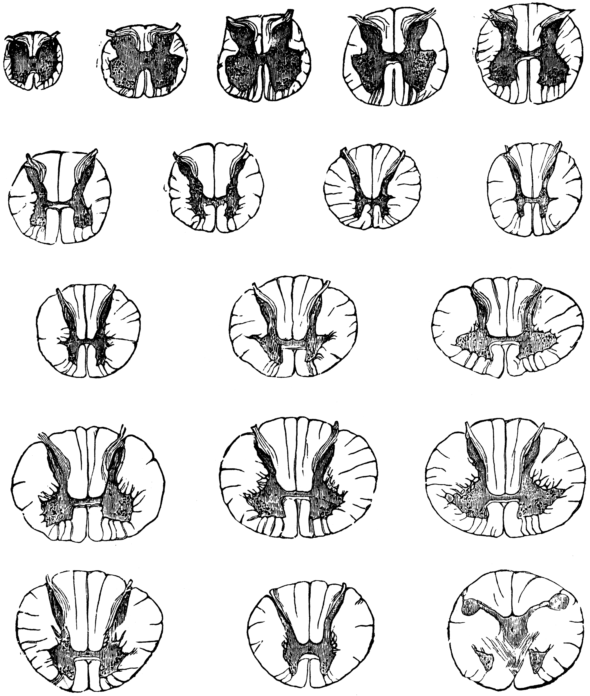 Transverse Sections Of Spinal Cord Clipart Etc