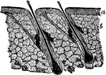 Section of the skin, showing the hair follicles, sebaceous glands, and the muscles of the hair. Labels: a, epidermis; b, dermis; c, muscles of the hair follicles; d, sebaceous glands.