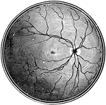 The right retina as it would be seen if the front part of the eyeball with the lens and vitreous humor were removed. The white disk to the right marks the entry of the optic nerve (blind spot); the lines radiating from this are the retinal arteries and veins. The small central dark patch is the yellow spot, the region of most acute vision.