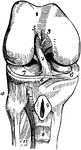 The knee joint, which consists of three articulations in one.