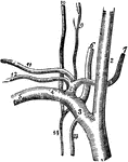 The subclavian artery.
