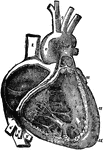 The right auricle (atrium) and ventricle of the heart opened, and a part of their right and anterior walls removed, so as to show their interior; 1/2, 1, superior vena cava; 2, inferior vena cava; 2', hepatic veins cut short; 3, right auricle; 3', placed in the fossa ovalis, below which is the Eustachian valve; 3", is placed close to the aperture of the coronary vein; +, +, placed n the auriculo-ventricular groove, where a narrow portion of the adjacent walls of the auricle and ventricle has been preserved; 4, 4, cavity of the right ventricle; the upper figure is immediately below the semilunar valves; 4', large columna carnea or musculus papillaris; 5, 5', 5", tricuspid valve; 6, placed in the interior o the pulmonary artery, a part of the anterior wall of that vessel having been removed, and a narrow portion of it preserved at its commencement where the semilunar valves are attached; 7, concavity of the aortic arch close to the cord of the ductus arteriosus; 8, ascending part of sinus of the arch covered at its commencement by the auricular appendix and pulmonary artery; 9, placed between the innominate and left carotid arteries; 10, appendix of the left auricle; 11, 11, the outside of the left ventricle, the lower figure near the apex.