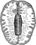 Cross-section of the brain. Here the upper half of the brain is cut off, and you see the upper cut surface of the lower half. The outer shaded part is the gray matter, and the inner lighter area is the white matter. In the center is the corpus callosum, a type of white matter that connects the two hemispheres together.
