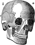The human skull, showing the bones of the head. <em>a</em>is the large bone of the forehead known as the frontal bone; <em>b</em> is known as the parietal bone, and <em>c</em> is the temporal bone.