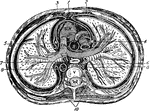 Transverse section of the thorax. Labels: 1, anterior mediastinum; 2, internal mammary vessels; 3, triangularis sterni; 4, 5, phrenic nerves; 6, thoracic duct; 7, esophagus; 8, vena azygos major; 9, thoracic aorta; 10, sympathetic; R. V., right ventricle; R. A., right auricle; P. A. pulmonary artery; A., aorta; C., superior vena cava; V., dorsal vertebra.