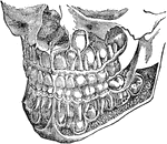 The deciduous and permanent teeth, shown as they are placed in the jaw with portions of bone removed to reveal the roots.