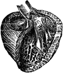 Three-quarters view of the left ventricle after removing front walls.