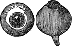 Front and side view of the eyeball.