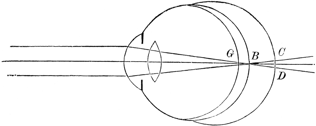 The Position Of The Retina In Near And Far Sight Clipart Etc