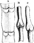 Diagram showing valves of veins. A, part of a vein laid open and spread out with two pairs of valves. B, longitudinal section of a vein, showing the apposition of the edges of the valves in their closed state. C, portion of a distended vein, exhibiting a swelling in the situation of a pair of valves.