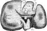 The under surface of the liver. Labels: G.B., gallbladder; H.D., common bile duct; H.A.; hepatic artery; V. P., portal vein; L.Q., lobulus quadratus; L.S., lobulus spigelii; L.C., lobulus caudatus; D.V., ductus venosus; U.V.,umbilical vein.